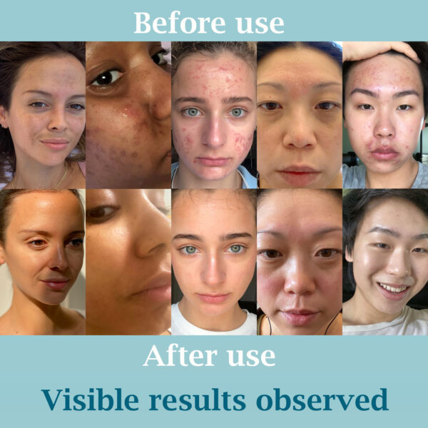 ClearCut Vitamin C 15% | Niacinamide 10% | Alpha Arbutin 0.5% | Retinol 0.3% | Face serum dark spot removal Rice water Hyaluronic acid 30 ml - Image 5
